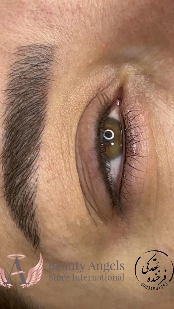 بن مژه اصفهان