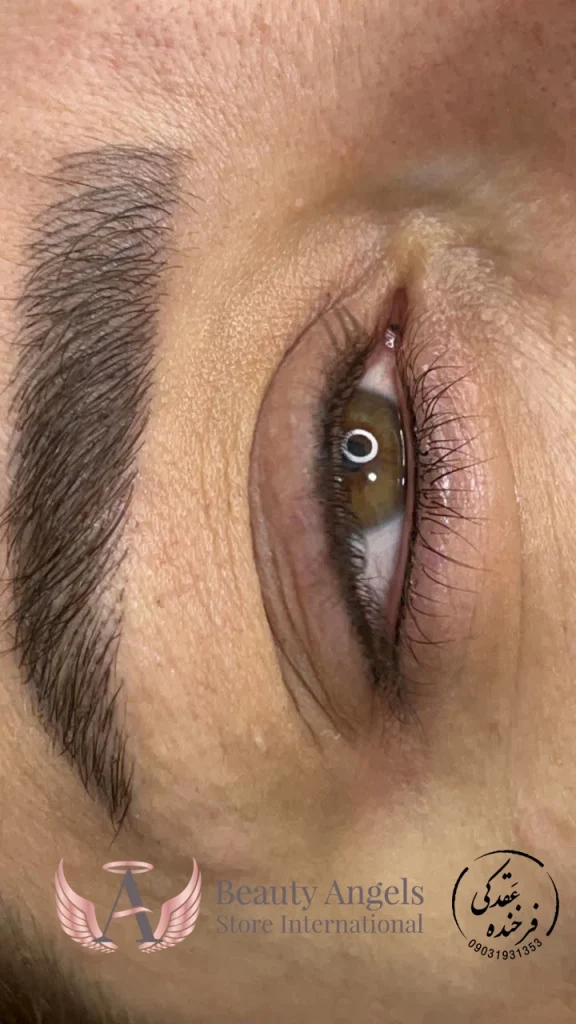 بن مژه اصفهان