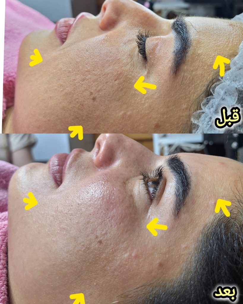 راضیه چراغی