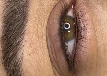 فیبروز ابرو فرخنده عقدکی فیبروز ابرو فرخنده عقدکی