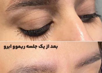 ریمو ابرو فرخنده عقدکی ریمو ابرو